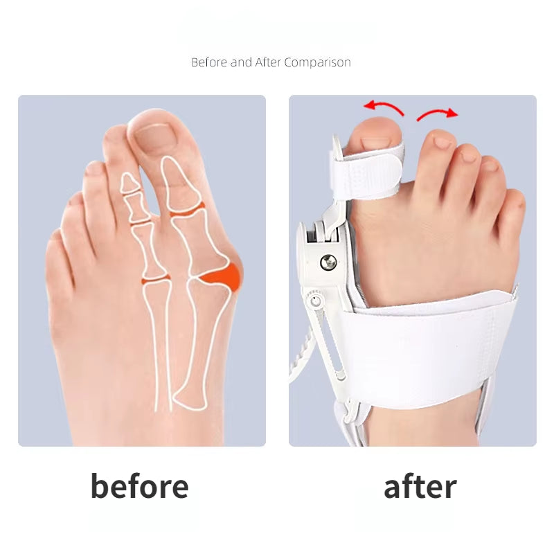 Hallux Valgus Corrector Bunions for Toes Corrector Foot Finger Separator Toe Separator Foot Care Bunion Corrector